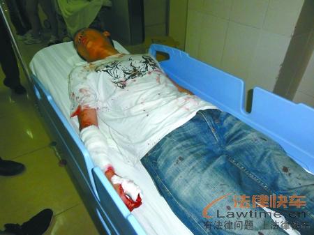 男子东莞抓小偷割断6根手筋