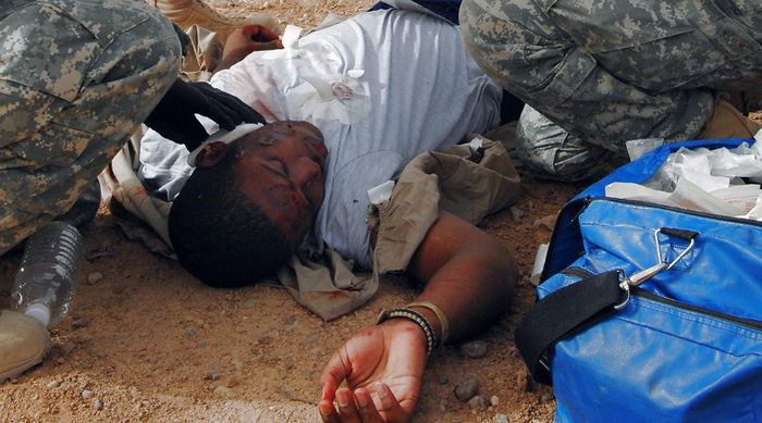 临时工工伤怎么处理